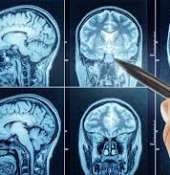 '' TUMORI  AL  CERVELLO -LE  STATISTICHE  - Informazioni -NATIONAL  BRAIN  TUMOR  SOCIETY ''